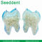 Dental Temporary Crown / Dental Crowns for Anterior and Posterior Teeth supplier
