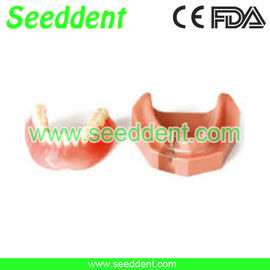 China Overdenture inferior with 2 implants supplier