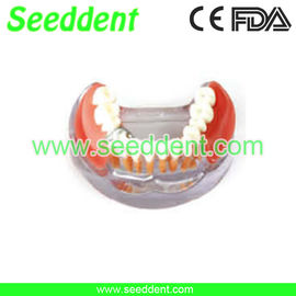 China Implant &amp; restoration model supplier