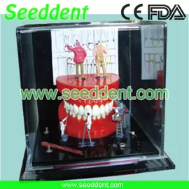 China Shadow box mini set of teeth II supplier