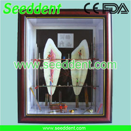 China Shadow box tooth with nerve supplier
