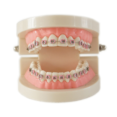 China Dental Teeth Teaching Study Model Set Orthodontic Model with Metal Bracket /dental bracket Standard model of dentures supplier