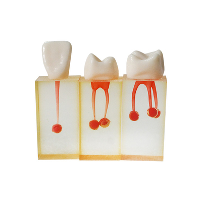 China Medical Students Dental Canal Teeth Practice Model 3PCS Dental Teaching Products Transparent Teeth Root Model supplier