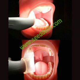 Intraoral Lighting System SE-L013 supplier