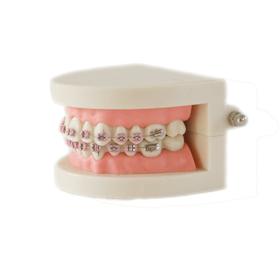 Dental Teeth Teaching Study Model Set Orthodontic Model with Metal Bracket /dental bracket Standard model of dentures supplier
