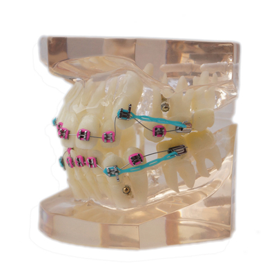 SE-MOB8-01 Dental teeth teaching study model full Orthodontic Metal Bracket supplier