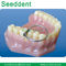 Dental Sectional Contoured Metal Matrices Kit / Dental Matrix Band Kit supplier