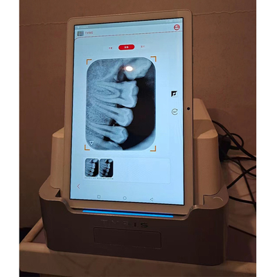 Dental X-ray Intraoral Digital Imaging Phosphor Plate PSP Scanner Dental Digital X Ray Scanner with Phosphor Plate supplier