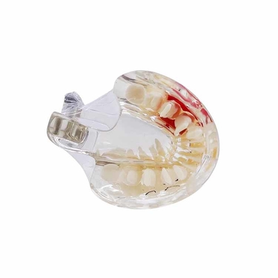 Dental University Teaching Products Dental Education Model Clear Mixed with Missing Teeth Model supplier