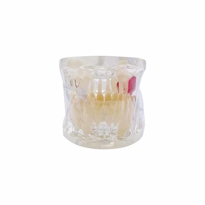 Dental University Teaching Products Dental Education Model Clear Mixed with Missing Teeth Model supplier
