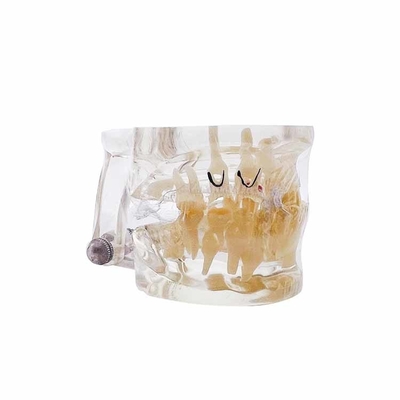 Dental University Teaching Products Dental Education Model Clear Mixed with Missing Teeth Model supplier