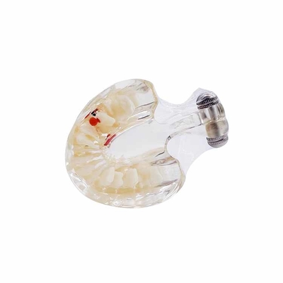 Dental University Teaching Products Dental Education Model Clear Mixed with Missing Teeth Model supplier