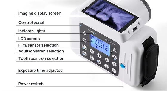 High Frequency Portable Dental Small/ Large Sensor 60kV/2mA Medical X-Ray Machine Set Color Large Screen Dental X-ray Unit supplier