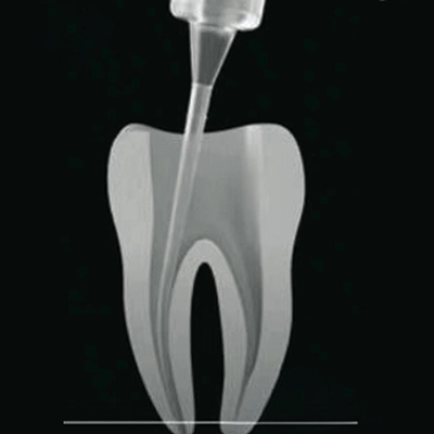 Hot Dental Dentist Products Disposable Flexible Root Canal Cleaning Tips 20pcs/box supplier