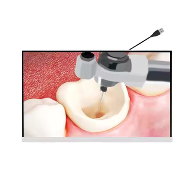 Dental Products Equipment Micro Lens Visual Micro Camera for Root Canal Treatment Dental HD Micro Oral Camera supplier