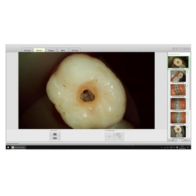 Dental Products Micro Lens Visual Micro Camera for Root Canal Treatment Dental HD Micro Oral Camera supplier