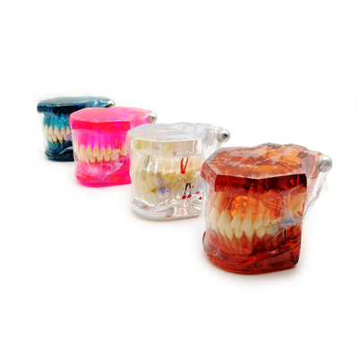 Oral Pathology Teaching Doctor-Patient Comprehensive Prosthesis Dental Restoration Implant Model supplier