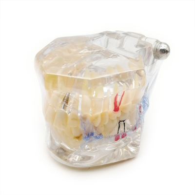Oral Pathology Teaching Doctor-Patient Comprehensive Prosthesis Dental Restoration Implant Model supplier