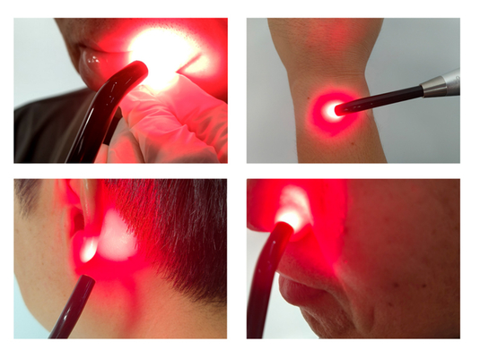 New Arrivals Professional Oral Treatment Red Light Therapy Device for Cold Sore and Canker Sore Relief supplier