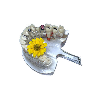 Dental Video Microscope Cart Type or Dental Unit Type with Monitor Use the Monitor Only supplier