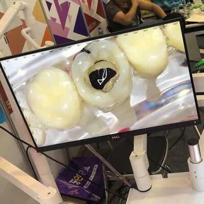 Dental Video Microscope Cart Type or Dental Unit Type with Monitor Use the Monitor Only supplier
