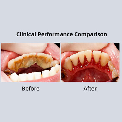 High Quality Dental Equipment Ultrasonic Periodontal Device Endodontic Treatment Product supplier