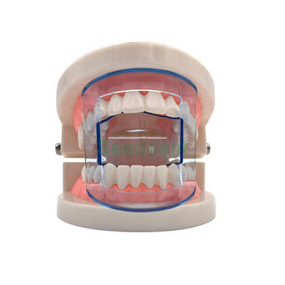 2021 New Dental Supply Plastic Disposable Lip Opener Intraoral Orthodontic Cheek Retractor Mouth Opener SE-U027/SE-U028 supplier