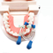 Autoclave Dental Forming Sheet Clip Matrix Bands Sectional Matrix Clip supplier