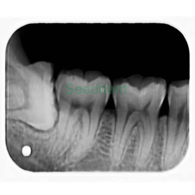 Dental X-Ray Image Plate Scanner Professional Intraoral Imaging supplier