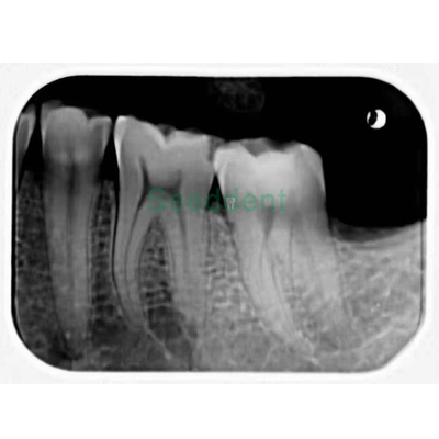 Dental X-Ray Image Plate Scanner Professional Intraoral Imaging supplier