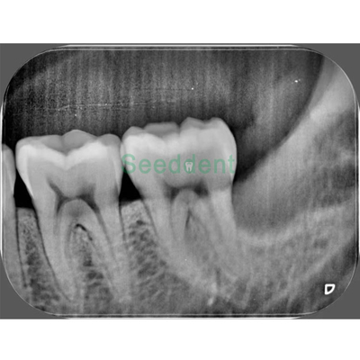 Dental X-Ray Image Plate Scanner Professional Intraoral Imaging supplier